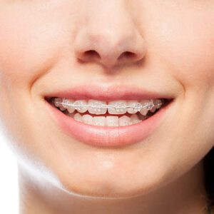 six month smiles cosmetic dentist near me