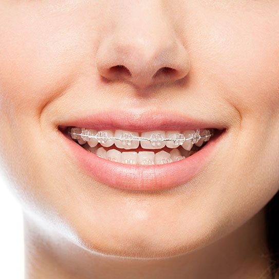 six month smiles cosmetic dentist near me